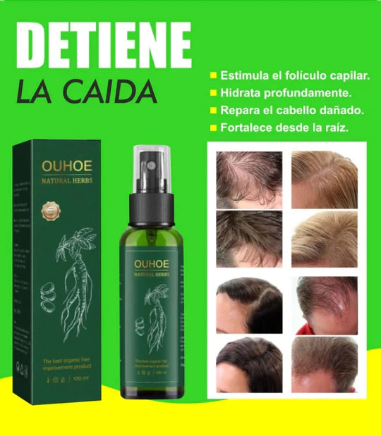 OUHOE - ELIXIR PARA EL CRECIMIENTO DEL CABELLO