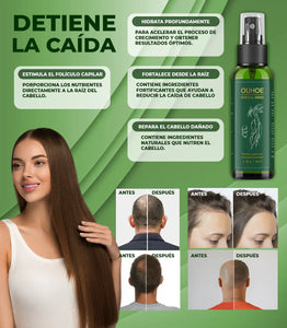 OUHOE - ELIXIR PARA EL CRECIMIENTO DEL CABELLO